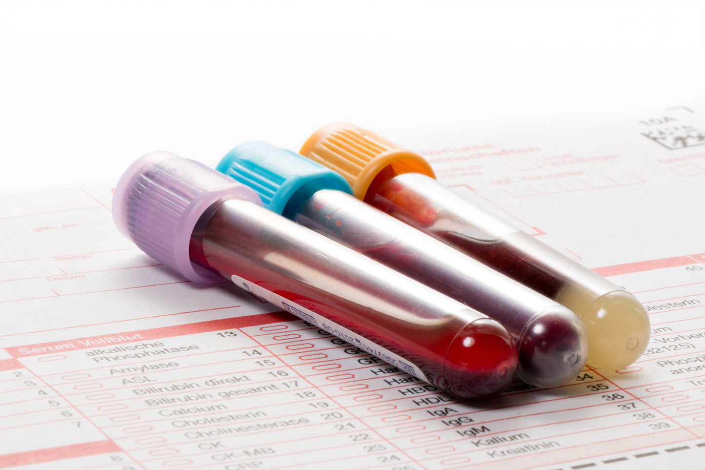 Leaky Gut Syndrome
